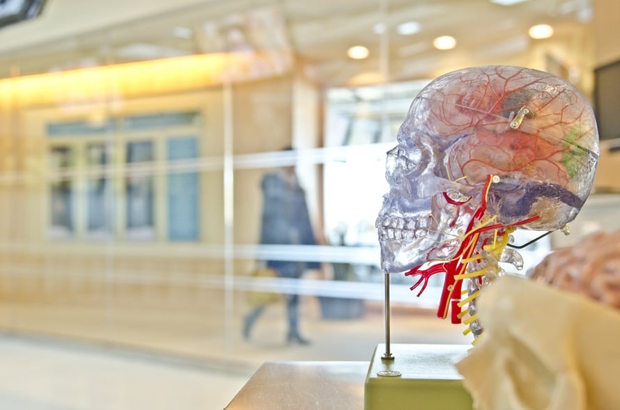 a model of a human skull with blood vessels attached to it